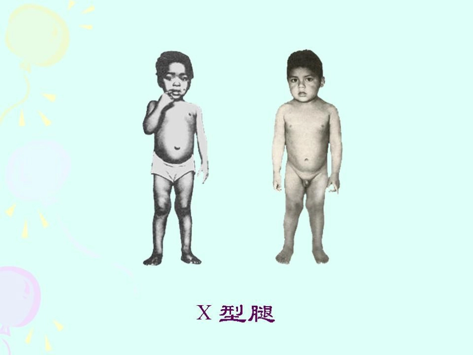 2016版佝偻病全球共识_第6页