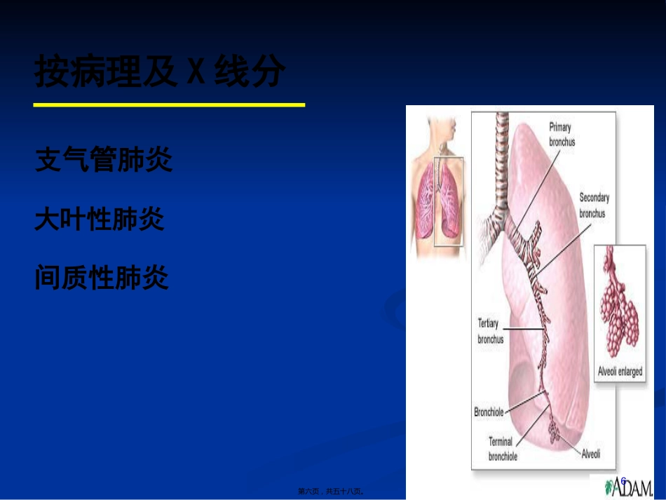 2022医学课件儿科-肺炎_第6页