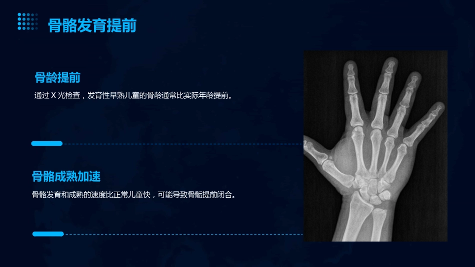 2024版儿童发育性早熟ppt课件_第12页
