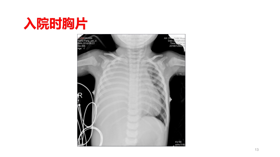 儿科常见五种疾病PPT课件_第13页