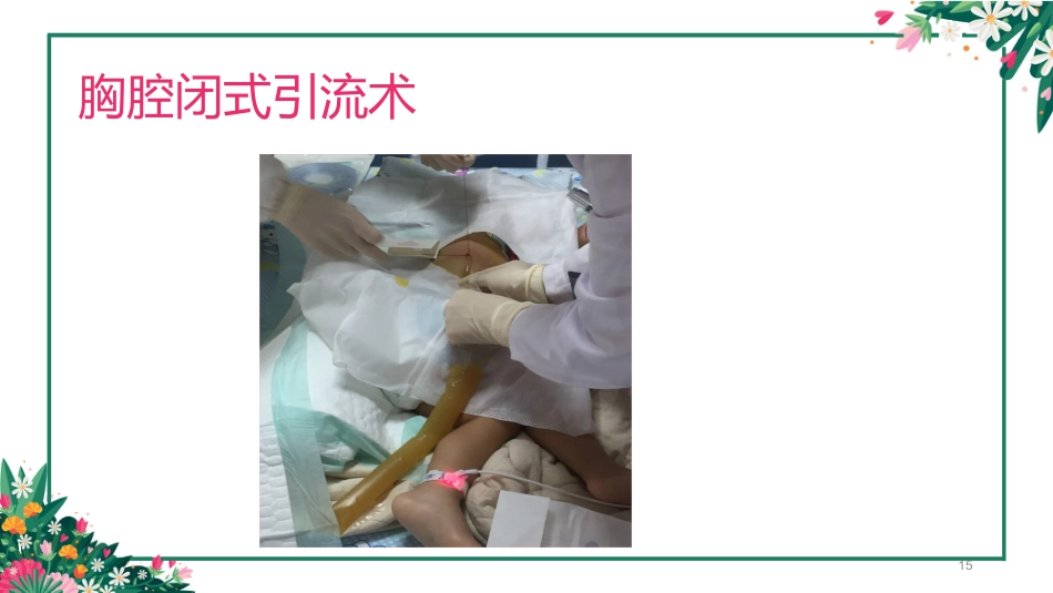 儿科常见五种疾病PPT课件_第15页