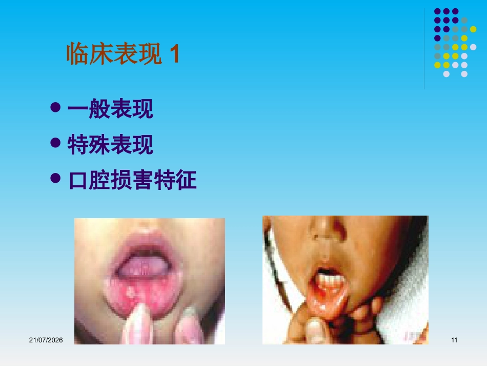 儿科呼吸道传染病的防治_第11页
