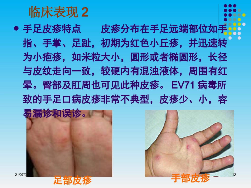 儿科呼吸道传染病的防治_第12页