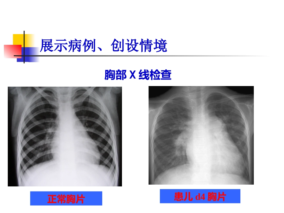 儿科呼吸PBL(PPT)_第7页