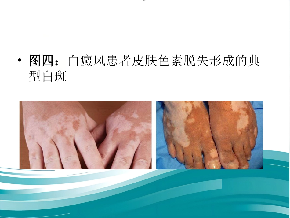儿科常见皮疹识别_第11页