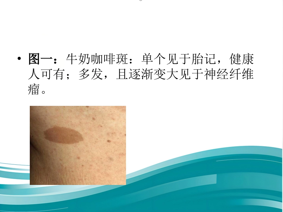 儿科常见皮疹识别_第8页