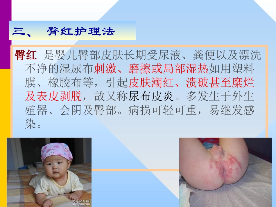 儿科常用护理技术_第10页