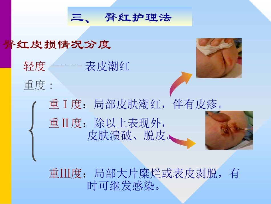 儿科常用护理技术_第11页
