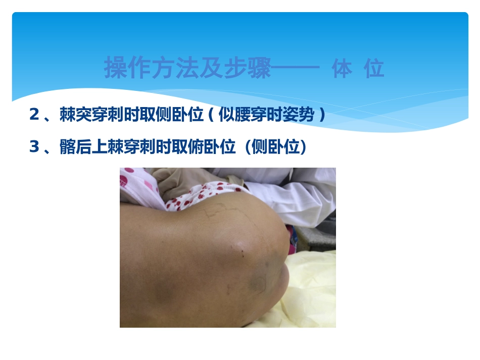 儿科规培操作骨髓穿刺_第14页