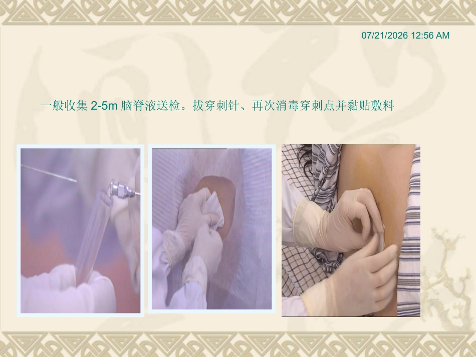 儿科常用穿刺术_第13页