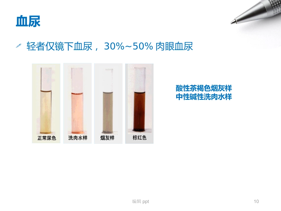 儿科护理急性肾小球肾炎_第10页
