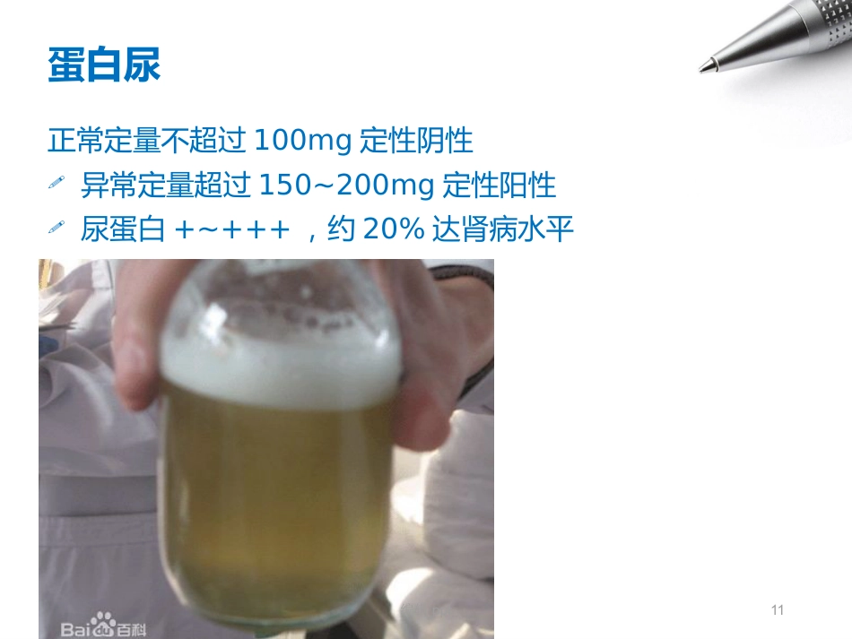 儿科护理急性肾小球肾炎_第11页