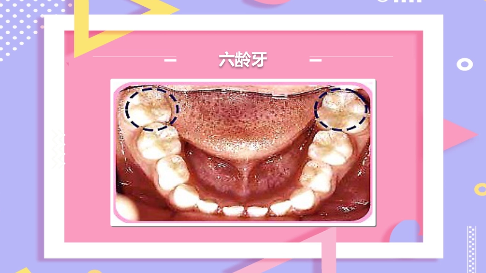 儿童口腔保健13_第10页