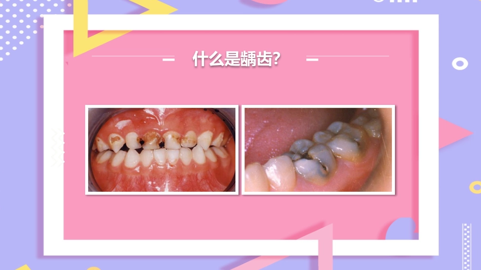 儿童口腔保健13_第12页