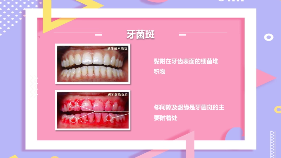 儿童口腔保健13_第14页