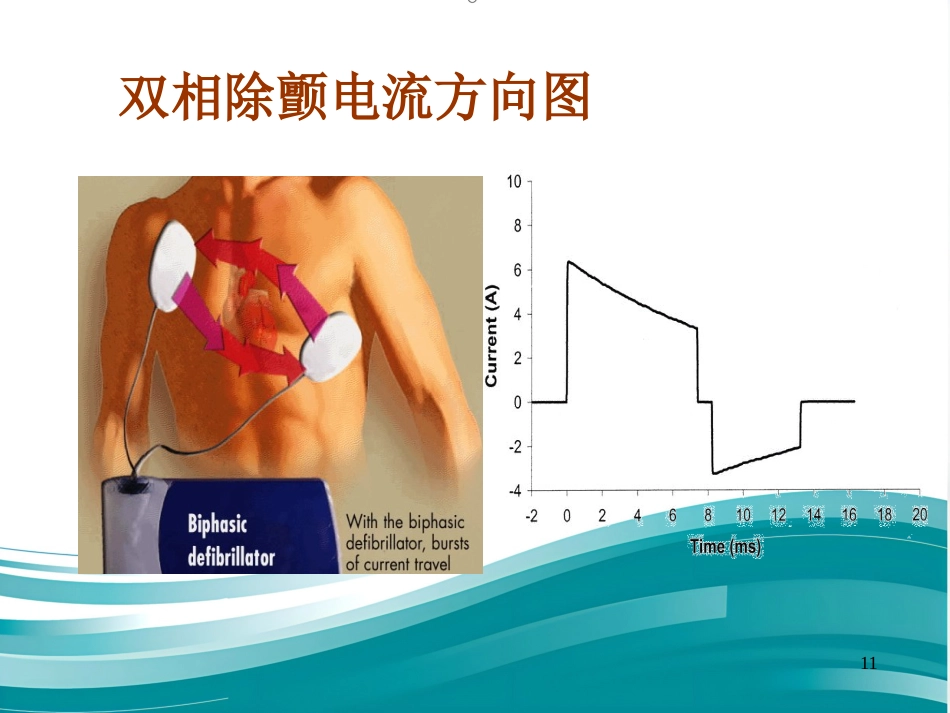 儿科电除颤_第11页