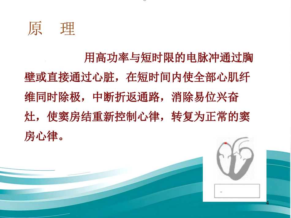 儿科电除颤_第4页
