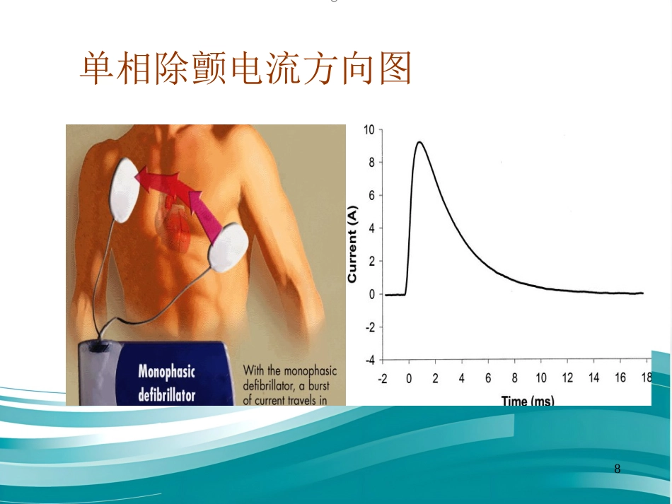 儿科电除颤_第8页