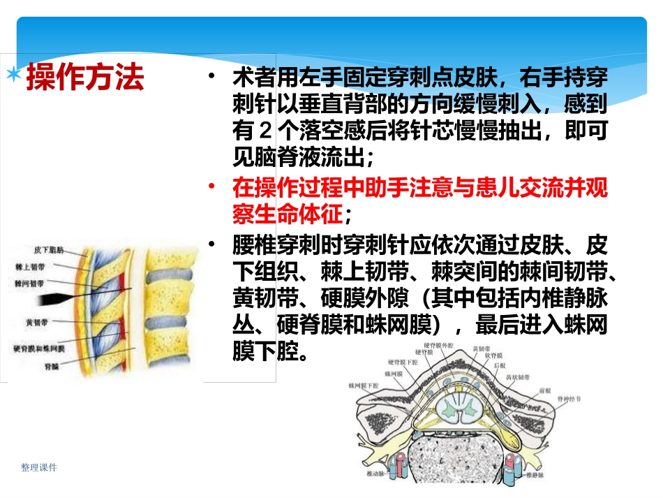 儿科规培操作腰椎穿刺_第7页