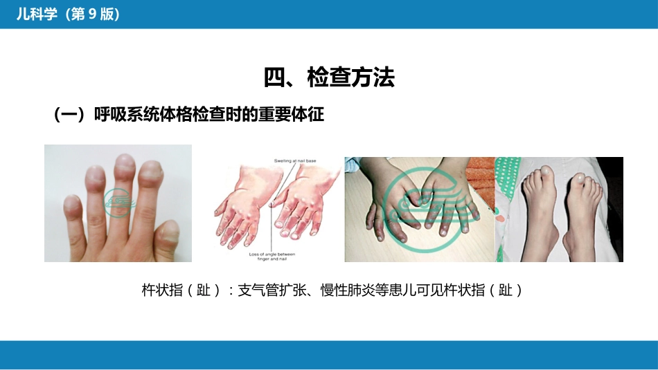 第十章 呼吸系统疾病 第一节-第五节_第11页