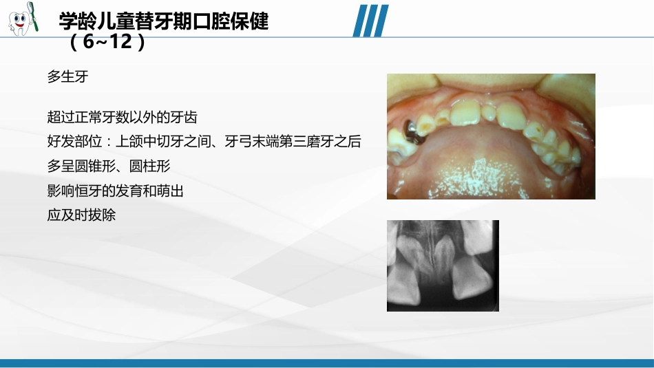 儿童口腔保健宣教39_第11页