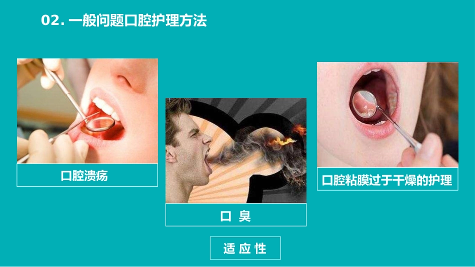 口腔护理医学医疗PPT43_第12页