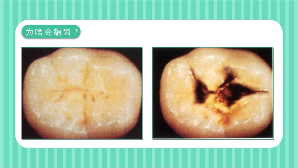 关爱牙齿健康48_第8页