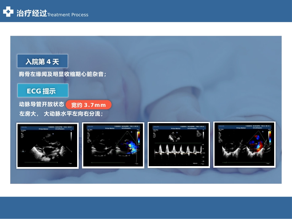 VLBW患儿临床病例分享_第8页