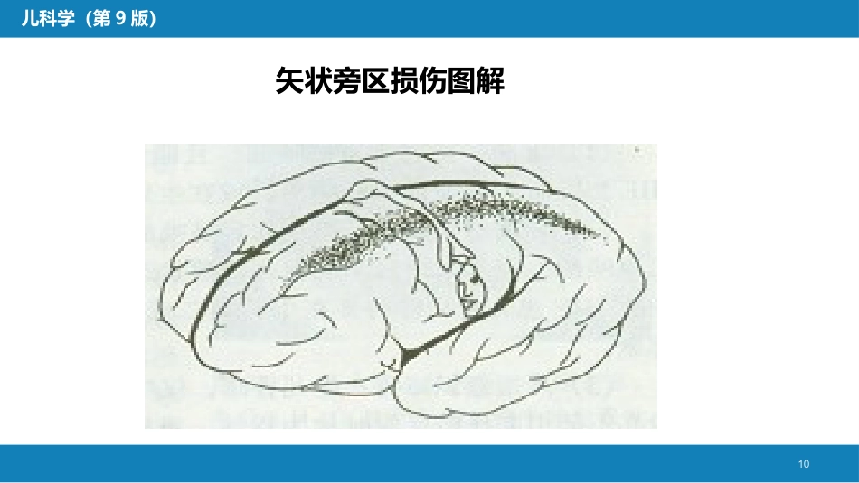 第六章 新生儿与新生儿疾病 第五节 新生儿缺氧缺血性脑病_第10页