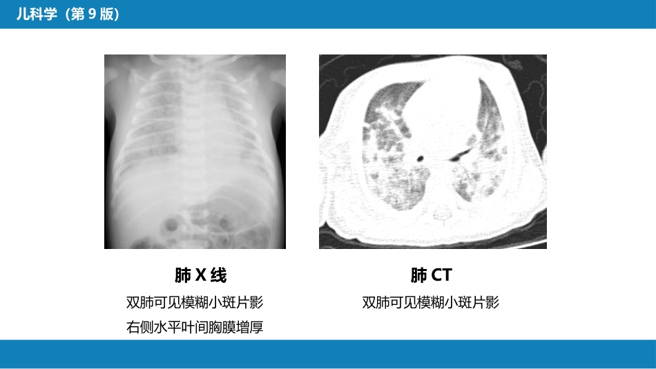 第六章 新生儿与新生儿疾病 第七节-第八节_第14页