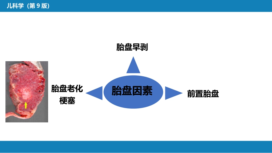第六章 新生儿与新生儿疾病 第一节 概述_第15页