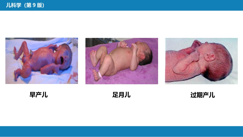 第六章 新生儿与新生儿疾病 第一节 概述_第7页