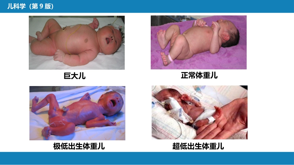 第六章 新生儿与新生儿疾病 第一节 概述_第9页