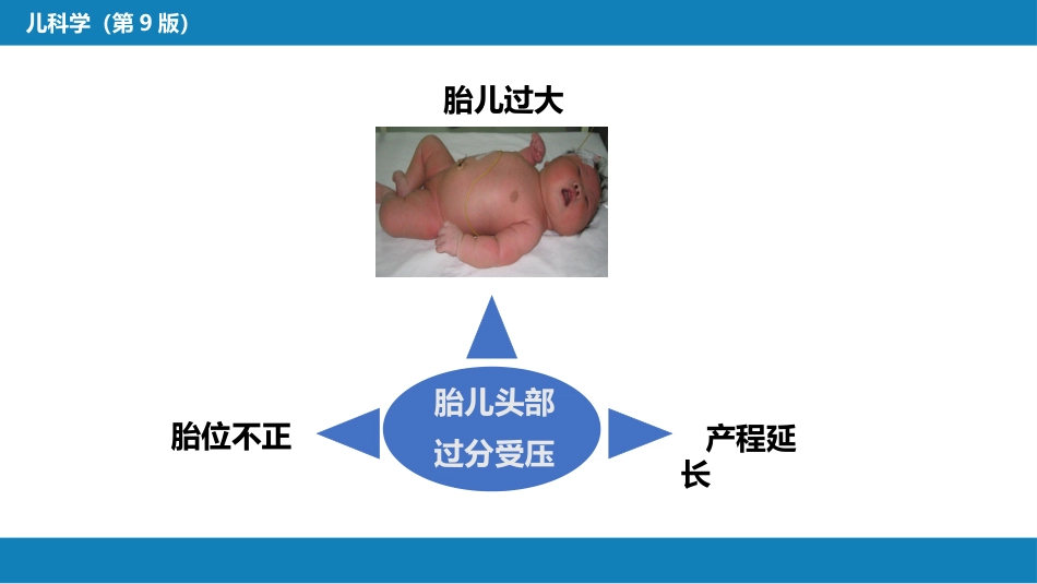 第六章 新生儿与新生儿疾病 第六节 新生儿颅内出血_第10页