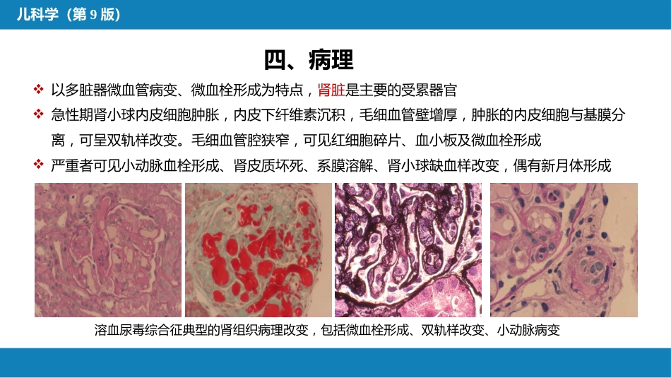 第十二章 泌尿系统疾病 第七节-第九节_第8页