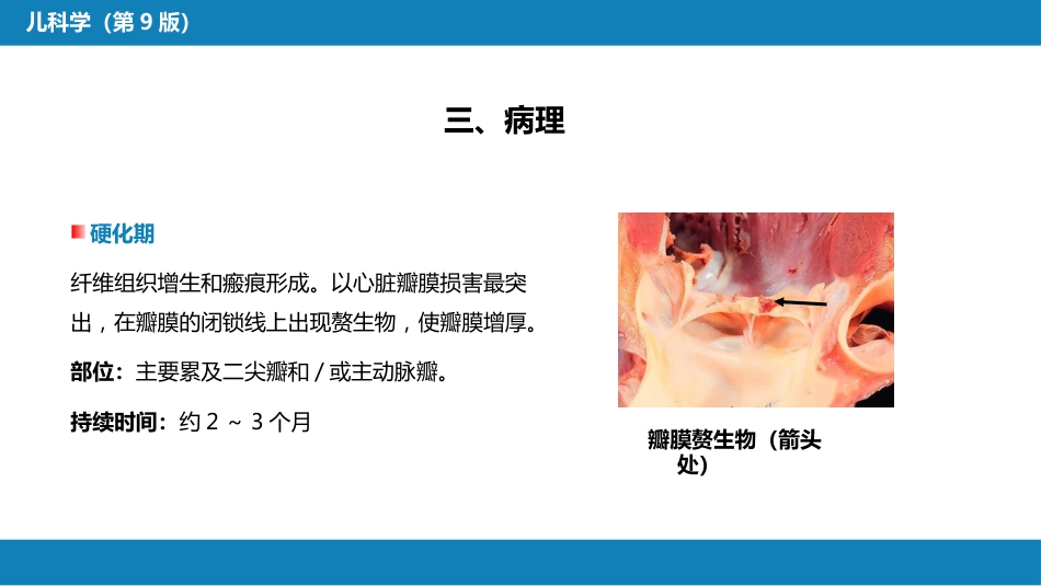 第七章 免疫性疾病 第四节-第八节_第11页