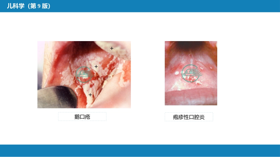 第九章 消化系统疾病_第10页