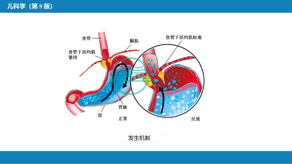 第九章 消化系统疾病_第13页