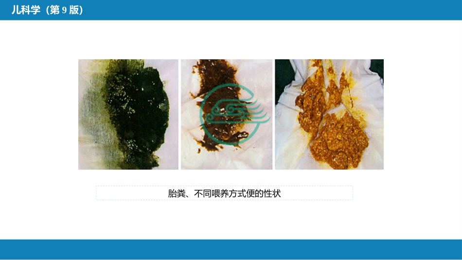 第九章 消化系统疾病_第8页