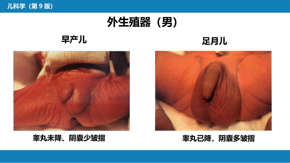 第六章 新生儿与新生儿疾病 第二节 正常足月儿和早产儿的特点与护理_第10页