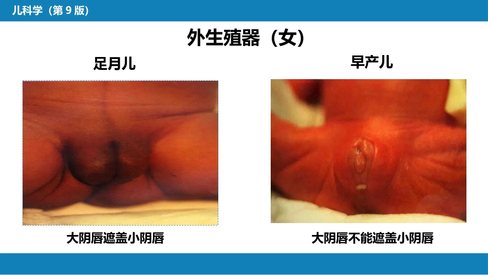 第六章 新生儿与新生儿疾病 第二节 正常足月儿和早产儿的特点与护理_第11页