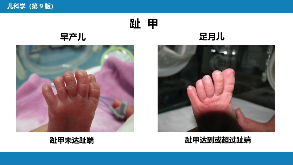 第六章 新生儿与新生儿疾病 第二节 正常足月儿和早产儿的特点与护理_第12页