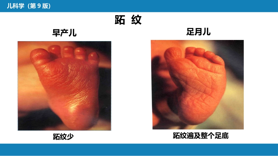 第六章 新生儿与新生儿疾病 第二节 正常足月儿和早产儿的特点与护理_第13页