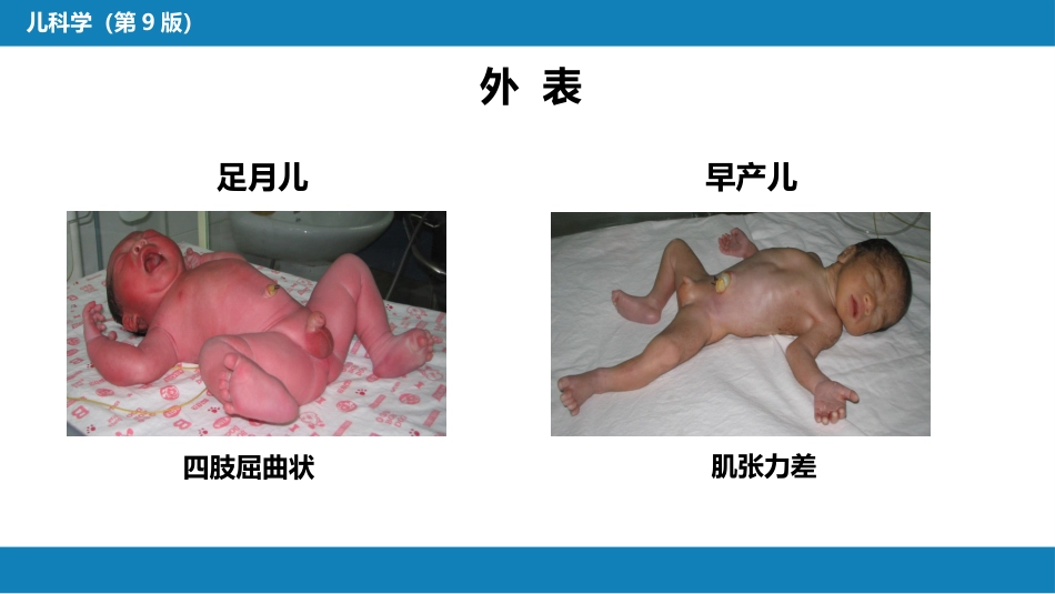 第六章 新生儿与新生儿疾病 第二节 正常足月儿和早产儿的特点与护理_第6页