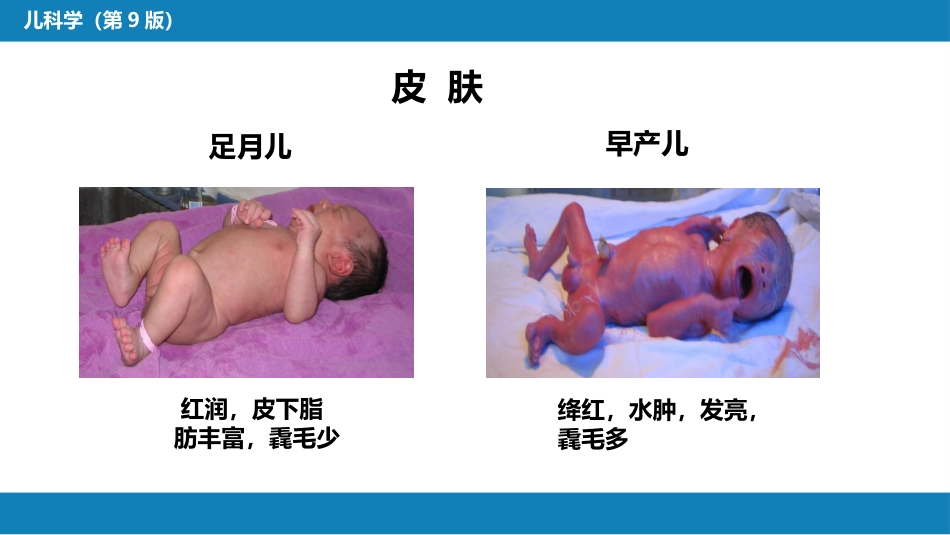 第六章 新生儿与新生儿疾病 第二节 正常足月儿和早产儿的特点与护理_第7页