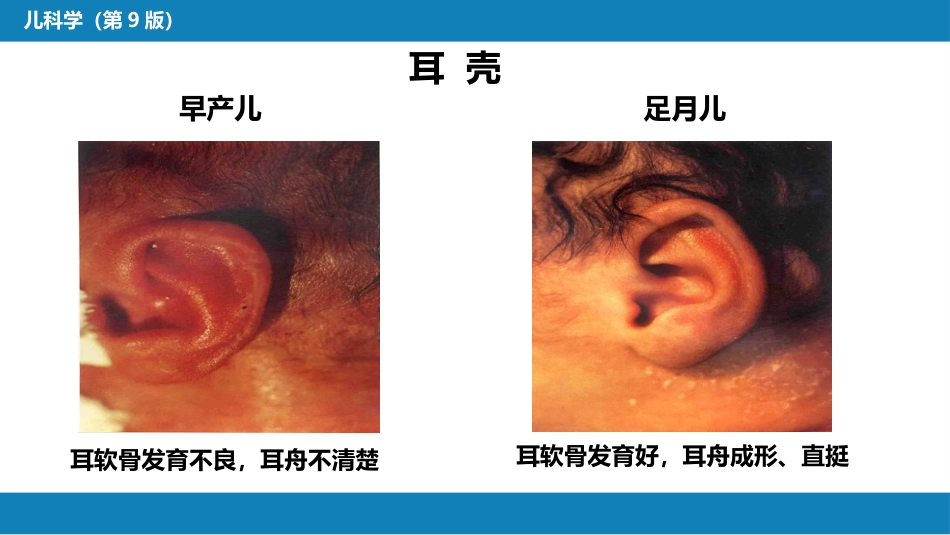 第六章 新生儿与新生儿疾病 第二节 正常足月儿和早产儿的特点与护理_第8页