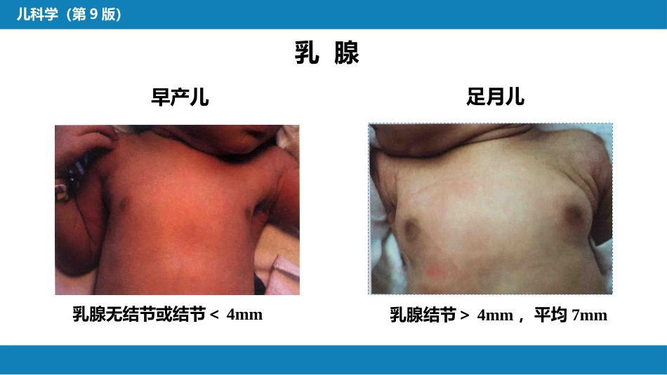第六章 新生儿与新生儿疾病 第二节 正常足月儿和早产儿的特点与护理_第9页