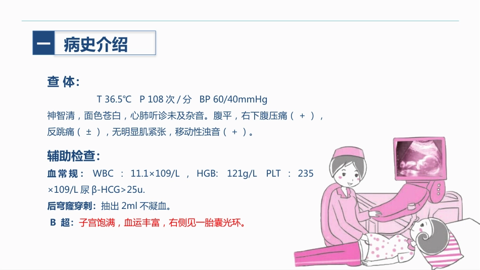 异位妊娠_第5页