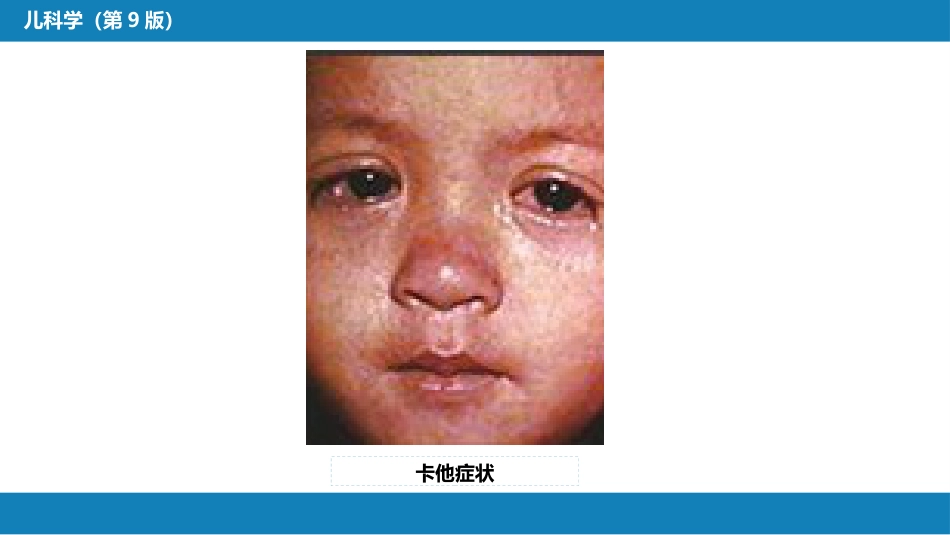 第八章 感染性疾病 第一节 病毒感染_第11页