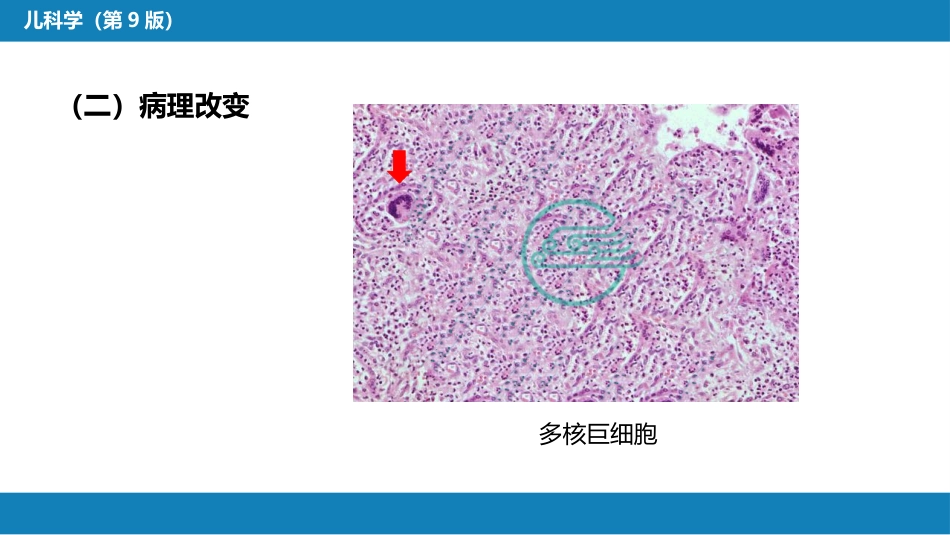 第八章 感染性疾病 第一节 病毒感染_第8页
